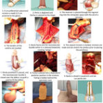 The Modified Sliding Technique (MoST)